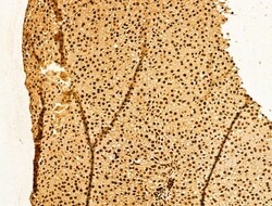 Invitrogen YTHDF2 Polyclonal Antibody 100 &mu;L; Unconjugated:Antibodies,