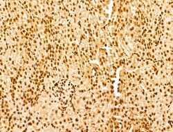 Invitrogen YTHDF2 Polyclonal Antibody 100 &mu;L; Unconjugated:Antibodies,