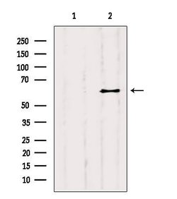 Invitrogen YTHDF2 Polyclonal Antibody 100 &mu;L; Unconjugated:Antibodies,