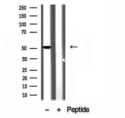 SLC30A6 Polyclonal Antibody:Antibodies, Polyclonal
