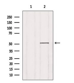 SLC30A6 Polyclonal Antibody:Antibodies, Polyclonal