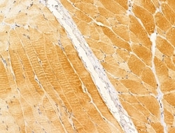 Invitrogen ACADS Polyclonal Antibody 100 &mu;L; Unconjugated:Antibodies,