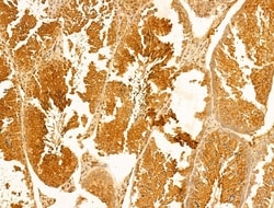 Invitrogen ACADS Polyclonal Antibody 100 &mu;L; Unconjugated:Antibodies,
