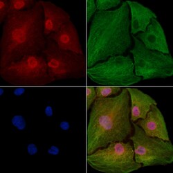 Invitrogen Annexin VII Polyclonal Antibody 100 &mu;L; Unconjugated:Antibodies,
