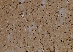 Invitrogen Annexin VII Polyclonal Antibody 100 &mu;L; Unconjugated:Antibodies,