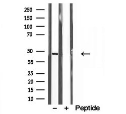 Invitrogen Annexin VII Polyclonal Antibody 100 &mu;L; Unconjugated:Antibodies,
