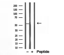 Invitrogen BCS1L Polyclonal Antibody 100 &mu;L; Unconjugated:Antibodies,