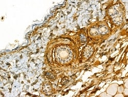 Invitrogen COL6A1 Polyclonal Antibody 100 &mu;L; Unconjugated:Antibodies,