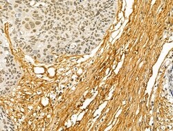 Invitrogen COL6A1 Polyclonal Antibody 100 &mu;L; Unconjugated:Antibodies,