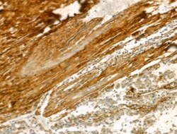 Invitrogen COL6A1 Polyclonal Antibody 100 &mu;L; Unconjugated:Antibodies,