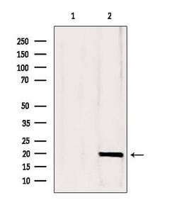 CPLX1 Polyclonal Antibody 100 &mu;L | Buy Online | Thermo Scientific | Fisher Scientific