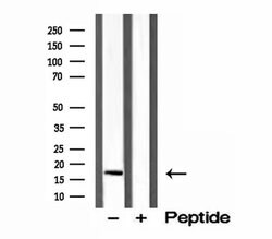CPLX1 Polyclonal Antibody 100 &mu;L | Buy Online | Thermo Scientific | Fisher Scientific