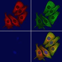 CYP26B1 Polyclonal Antibody, Invitrogen 100 &mu;L; Unconjugated:Antibodies,