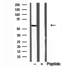 CYP26B1 Polyclonal Antibody, Invitrogen 100 &mu;L; Unconjugated:Antibodies,