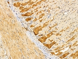 Invitrogen ERO1LB Polyclonal Antibody 100 &mu;L | Buy Online | Invitrogen&trade; | Fisher Scientific