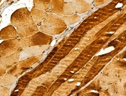 Invitrogen HLA-F Polyclonal Antibody 100 &mu;L; Unconjugated:Antibodies,