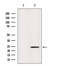 Invitrogen ICT1 Polyclonal Antibody 100 &mu;L; Unconjugated:Antibodies,