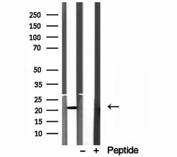 Invitrogen ICT1 Polyclonal Antibody 100 &mu;L; Unconjugated:Antibodies,