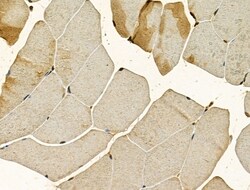 Invitrogen Importin 4 Polyclonal Antibody 100 &mu;L; Unconjugated:Antibodies,