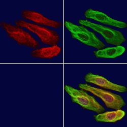 Invitrogen Importin 4 Polyclonal Antibody 100 &mu;L; Unconjugated:Antibodies,