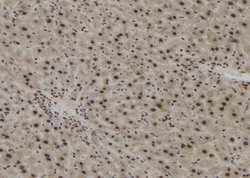 Invitrogen Importin 4 Polyclonal Antibody 100 &mu;L; Unconjugated:Antibodies,