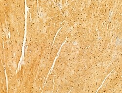 Invitrogen MAVS Polyclonal Antibody 100 &mu;L; Unconjugated:Antibodies,