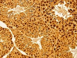 Invitrogen MMS19 Polyclonal Antibody 100 &mu;L; Unconjugated:Antibodies,