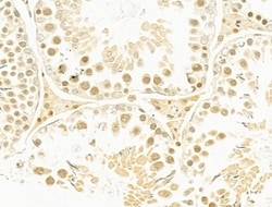 Invitrogen MMS19 Polyclonal Antibody 100 &mu;L; Unconjugated:Antibodies,