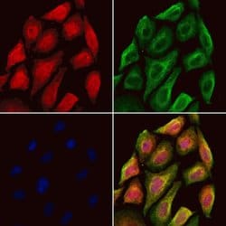 Invitrogen RBM4 Polyclonal Antibody 100 &mu;L; Unconjugated:Antibodies,