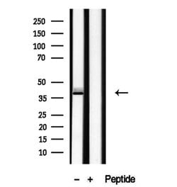Invitrogen RBM4 Polyclonal Antibody 100 &mu;L; Unconjugated:Antibodies,