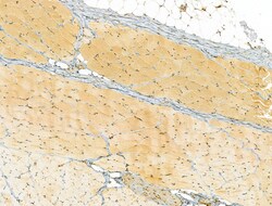 Invitrogen RCN2 Polyclonal Antibody 100 &mu;L; Unconjugated:Antibodies,