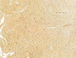 Invitrogen RCN2 Polyclonal Antibody 100 &mu;L; Unconjugated:Antibodies,