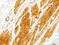 Invitrogen RCN2 Polyclonal Antibody 100 &mu;L; Unconjugated:Antibodies,