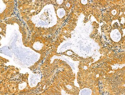 Invitrogen RCN2 Polyclonal Antibody 100 &mu;L; Unconjugated:Antibodies,