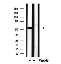 Invitrogen RCN2 Polyclonal Antibody 100 &mu;L; Unconjugated:Antibodies,