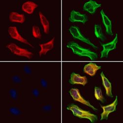 Invitrogen SEPT9 Polyclonal Antibody 100 &mu;L; Unconjugated:Antibodies,