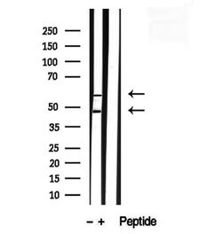 Invitrogen SEPT9 Polyclonal Antibody 100 &mu;L; Unconjugated:Antibodies,