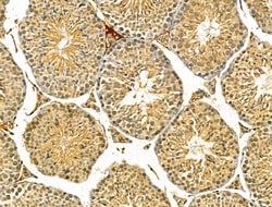 Invitrogen SEPT9 Polyclonal Antibody 100 &mu;L; Unconjugated:Antibodies,
