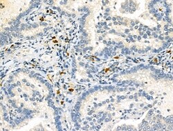 Invitrogen SEPT9 Polyclonal Antibody 100 &mu;L; Unconjugated:Antibodies,