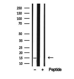 Invitrogen SNAPAP Polyclonal Antibody 100 &mu;L; Unconjugated:Antibodies,