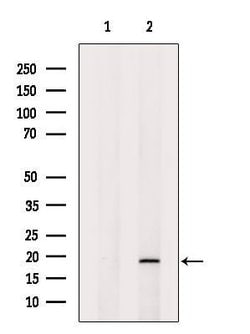 Invitrogen SNAPAP Polyclonal Antibody 100 &mu;L; Unconjugated:Antibodies,