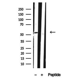 Invitrogen SPTLC2 Polyclonal Antibody 100 &mu;L; Unconjugated:Antibodies,