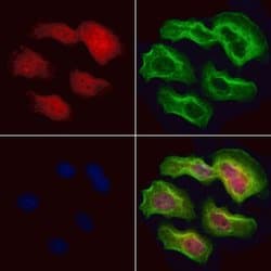 SRP68 Polyclonal Antibody:Antibodies, Polyclonal