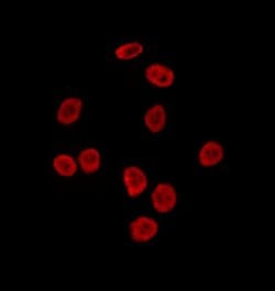 SRP68 Polyclonal Antibody:Antibodies, Polyclonal