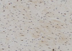 SRP68 Polyclonal Antibody:Antibodies, Polyclonal