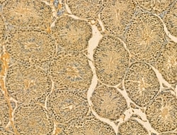 SRP68 Polyclonal Antibody:Antibodies, Polyclonal