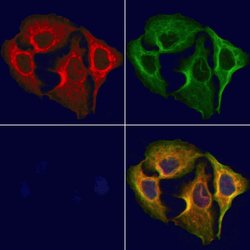 Invitrogen HRD1 Polyclonal Antibody 100 &mu;L; Unconjugated:Antibodies,