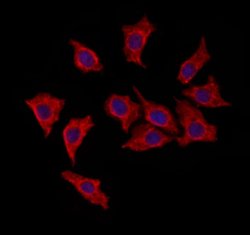 Invitrogen HRD1 Polyclonal Antibody 100 &mu;L; Unconjugated:Antibodies,
