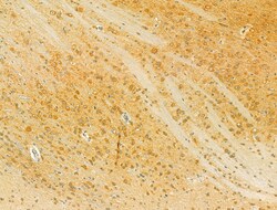 Invitrogen HRD1 Polyclonal Antibody 100 &mu;L; Unconjugated:Antibodies,