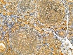 Invitrogen HRD1 Polyclonal Antibody 100 &mu;L; Unconjugated:Antibodies,